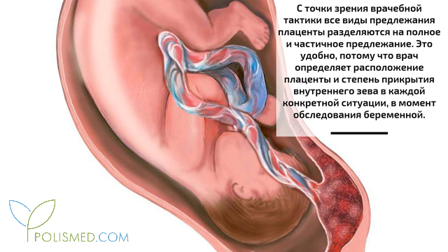 Сексуальная Анастасия Макеева – Правило Лабиринта - Плацента 2009