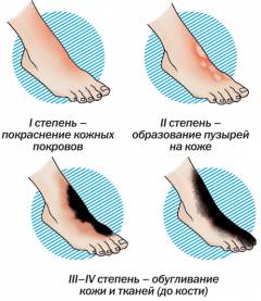 как определить площадь поражения при ожогах