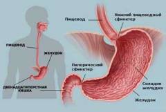 Полипы в желудке диета какие продукты противопоказаны