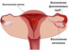 Почему болит внизу левый бок живота у девушки