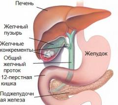 Что находится справа внизу живота у женщины и почему болит