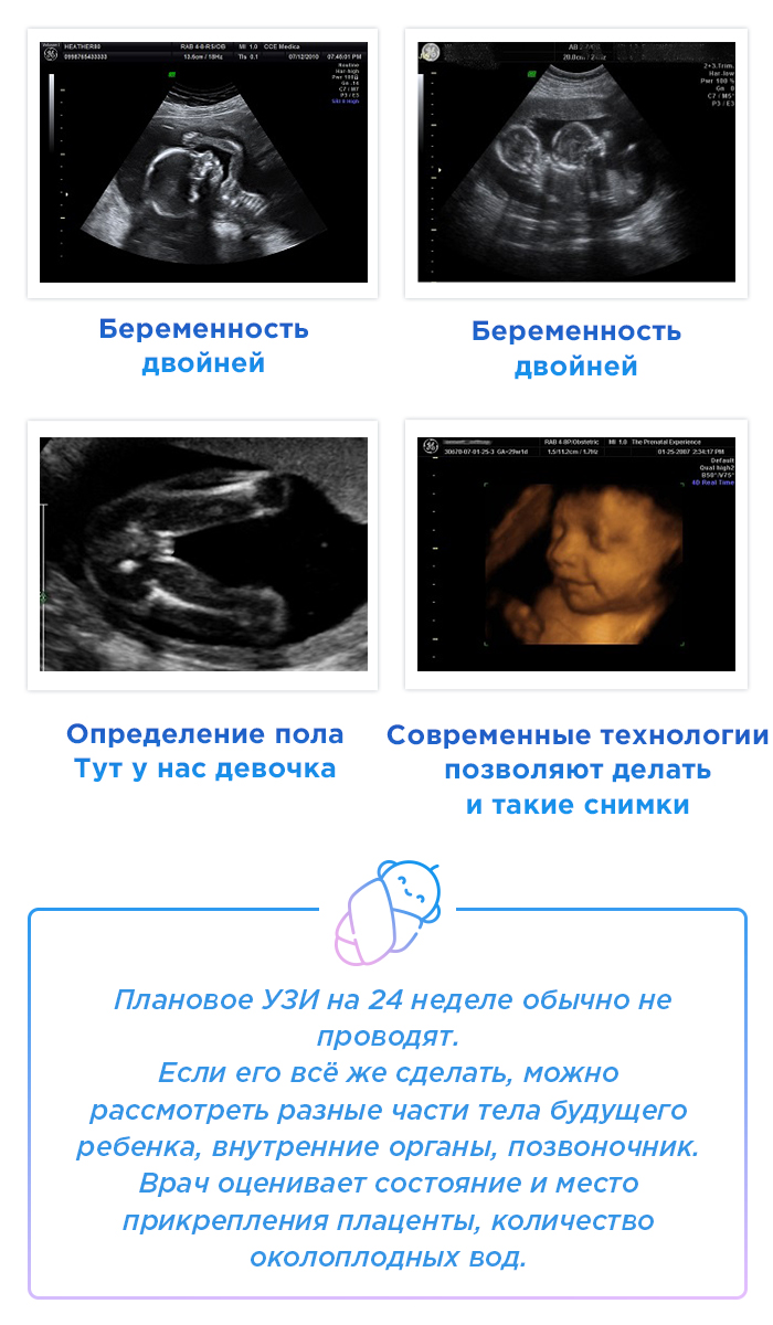 На каком сроке узи покажет пол ребенка