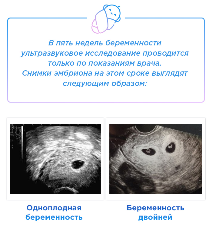 5 неделя беременности от последних месячных