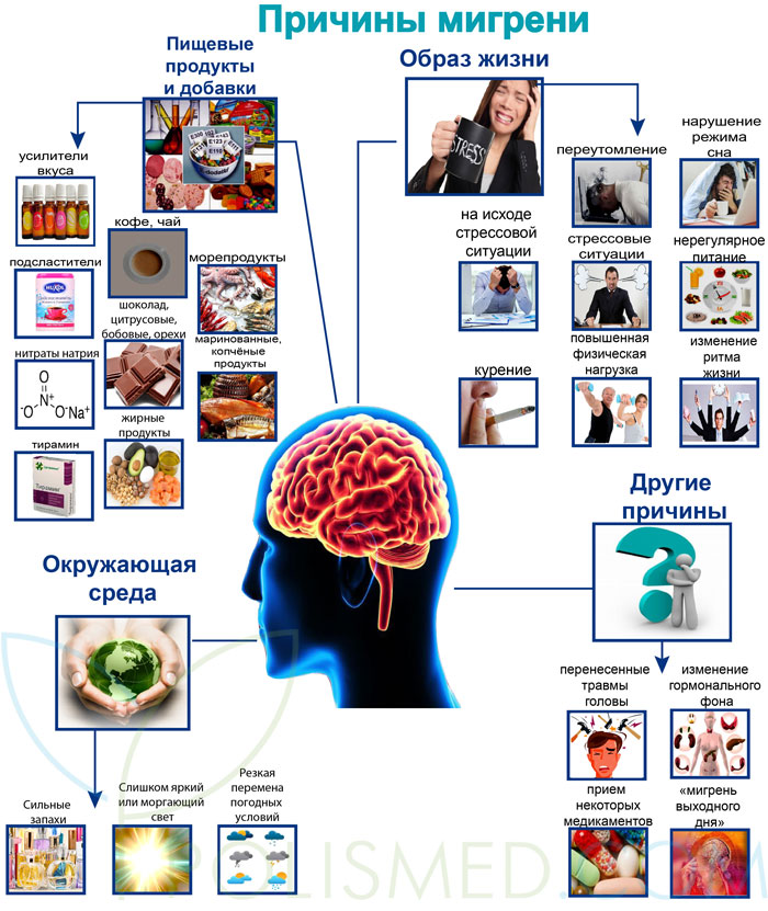 Мигрень симптомы у женщин. Мигрень симптомы. Мигрень головы симптомы. Мигрень признаки симптомы. Мигрень факторы возникновения.