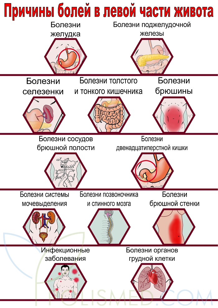 Почему болит внизу левый бок живота у девушки