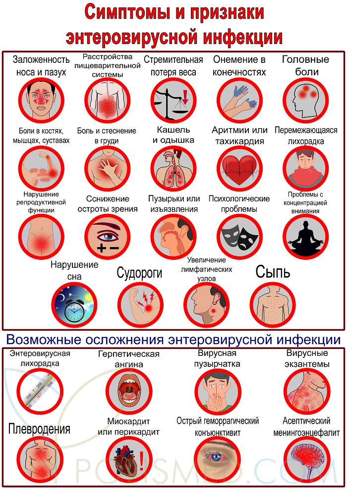 Ходит инфекция. Проявления энтеровируса у детей. Энтеровирусная инфекция. Интовипусная инфекции. Энтераирусная инфекции.