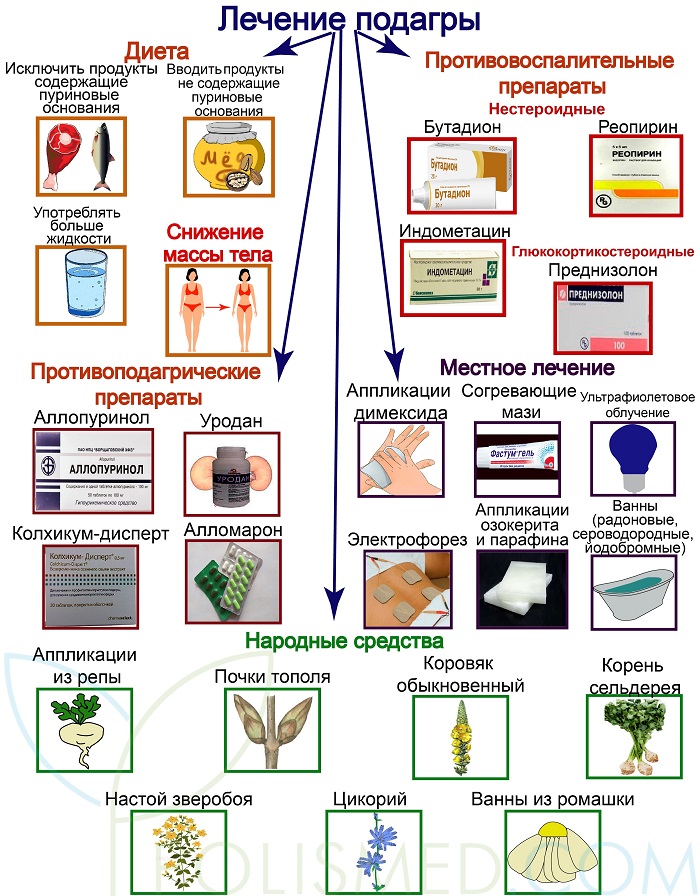 Лечение подагры