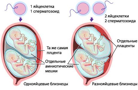 Можно ли заниматься сексом при беременности 6 недель