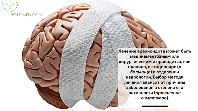 Арахноидит что это такое симптомы лечение. arahnoidit3. Арахноидит что это такое симптомы лечение фото. Арахноидит что это такое симптомы лечение-arahnoidit3. картинка Арахноидит что это такое симптомы лечение. картинка arahnoidit3.