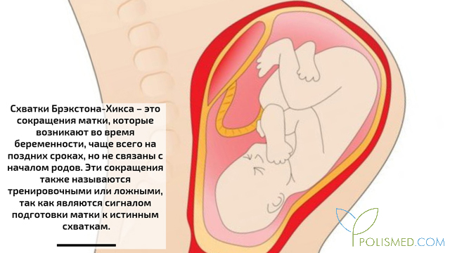 Схватки брекстона хикса что это такое. Смотреть фото Схватки брекстона хикса что это такое. Смотреть картинку Схватки брекстона хикса что это такое. Картинка про Схватки брекстона хикса что это такое. Фото Схватки брекстона хикса что это такое