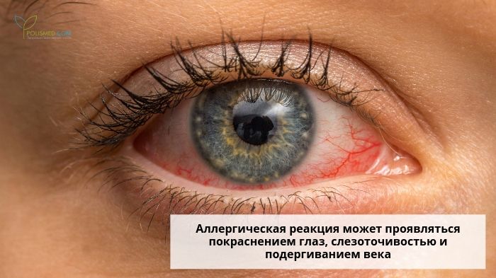 Покраснение глаза